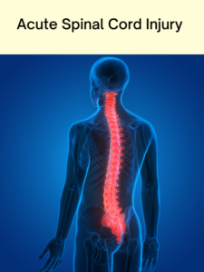 Coping with Acute Spinal Cord Injury: A Supportive Guide - NeuroHealth