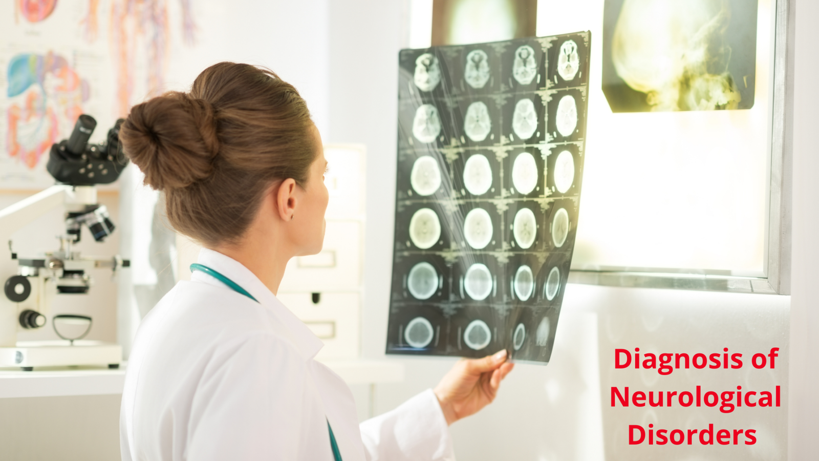 know-the-diagnosis-of-neurological-disorders-neurohealth