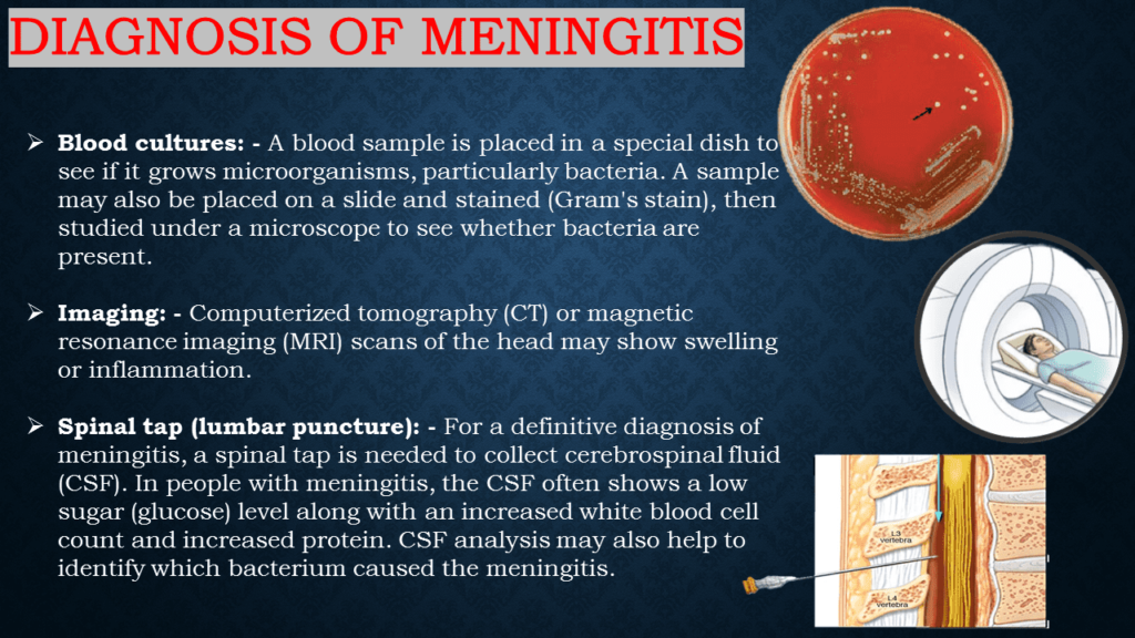 Diagnosis of Meningitis 