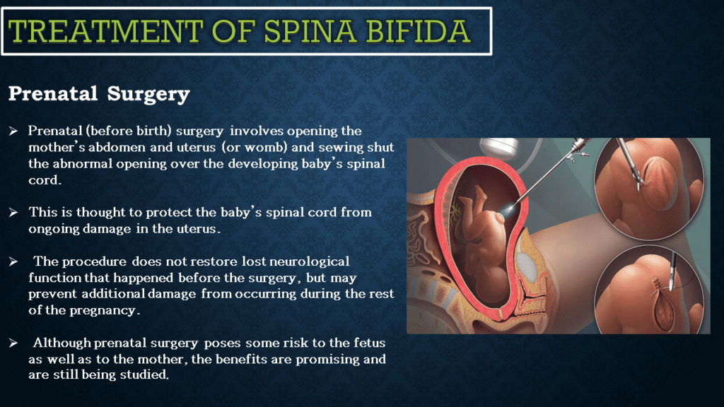 Neurological Disorder Spina Bifida Pictures Neurohealth 7166