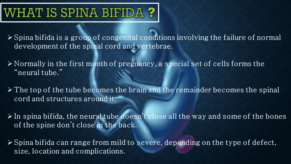 Spina bifida: what is it?