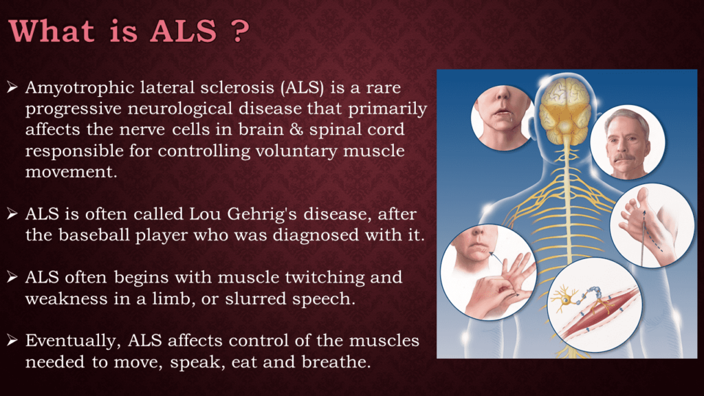 What is ALS ?
