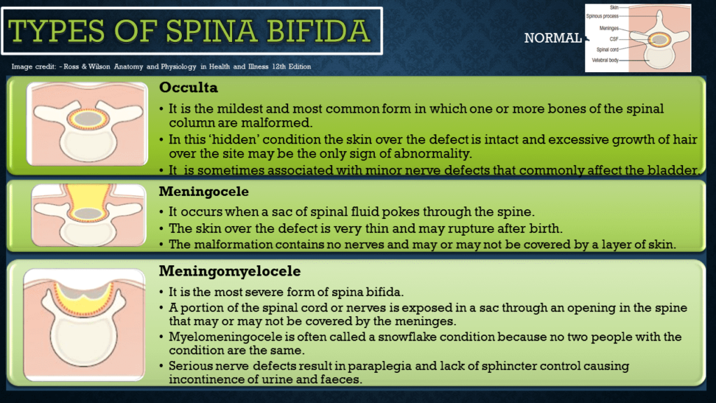 types of Spina bifida