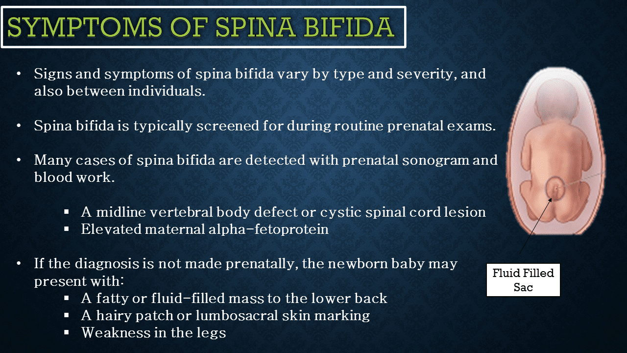 Neurological Disorder Spina bifida pictures - NeuroHealth