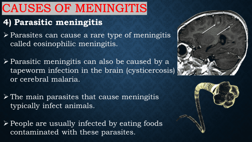 Causes of Meningitis 